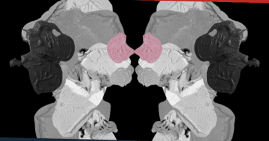 Cuarteto De Nos Ciudad Sin Alma Portada